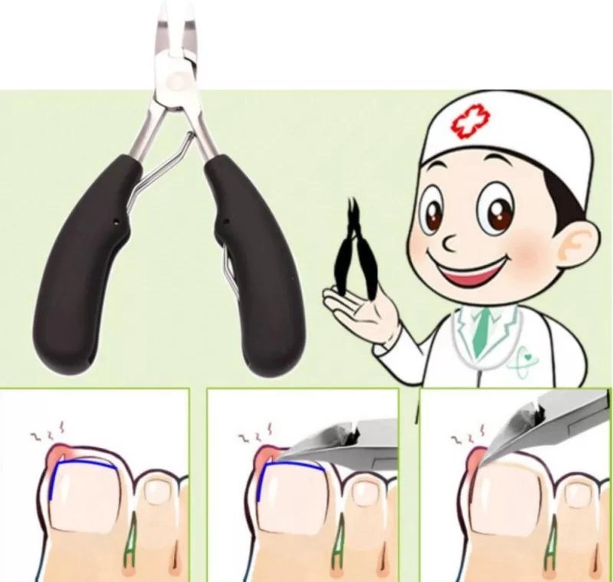 Professionele Nagelschaar Voor Ingegroeide Teennagels- Manicure - Pedicure - Voetverzorging 6 Professionele Nagelschaar Voor Ingegroeide Teennagels- Manicure - Pedicure - Voetverzorging - Afbeelding 4