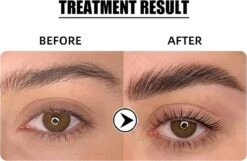 Flora Ruby - Wimper & Wenkbrauw Lifting Set 2 In 1 - Professionele 2 In 1 Lash Lift & Brow Lamination Kit - Permanente Wimperkruller -Cosmetica Promotiewinkel 1200x782