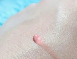 Biodermal Sun Lipbalm SPF25 - Tube 12 Ml - Natural Pink - Lippenbalsem -Cosmetica Promotiewinkel 1200x927